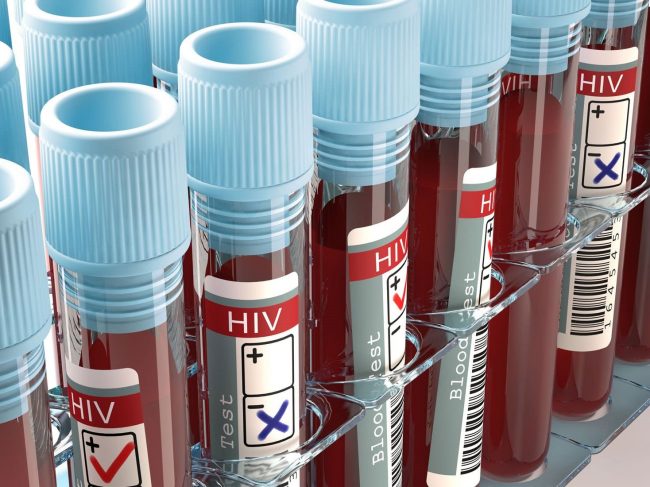 AGT Announces Progress with HIV Cure Program, Phase 1 Clinical Trial