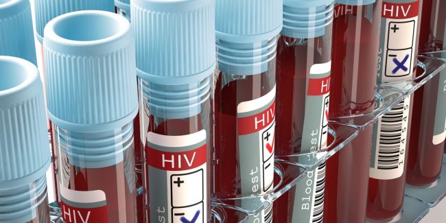AGT Announces Progress with HIV Cure Program, Phase 1 Clinical Trial
