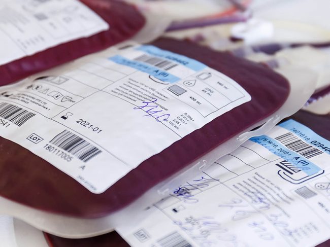 COVID-19 convalescent plasma did not prevent the progression of the disease