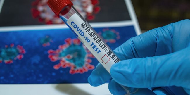 Новая тест-система позволит оценить развитие антительного иммунитета к SARS-CoV-2