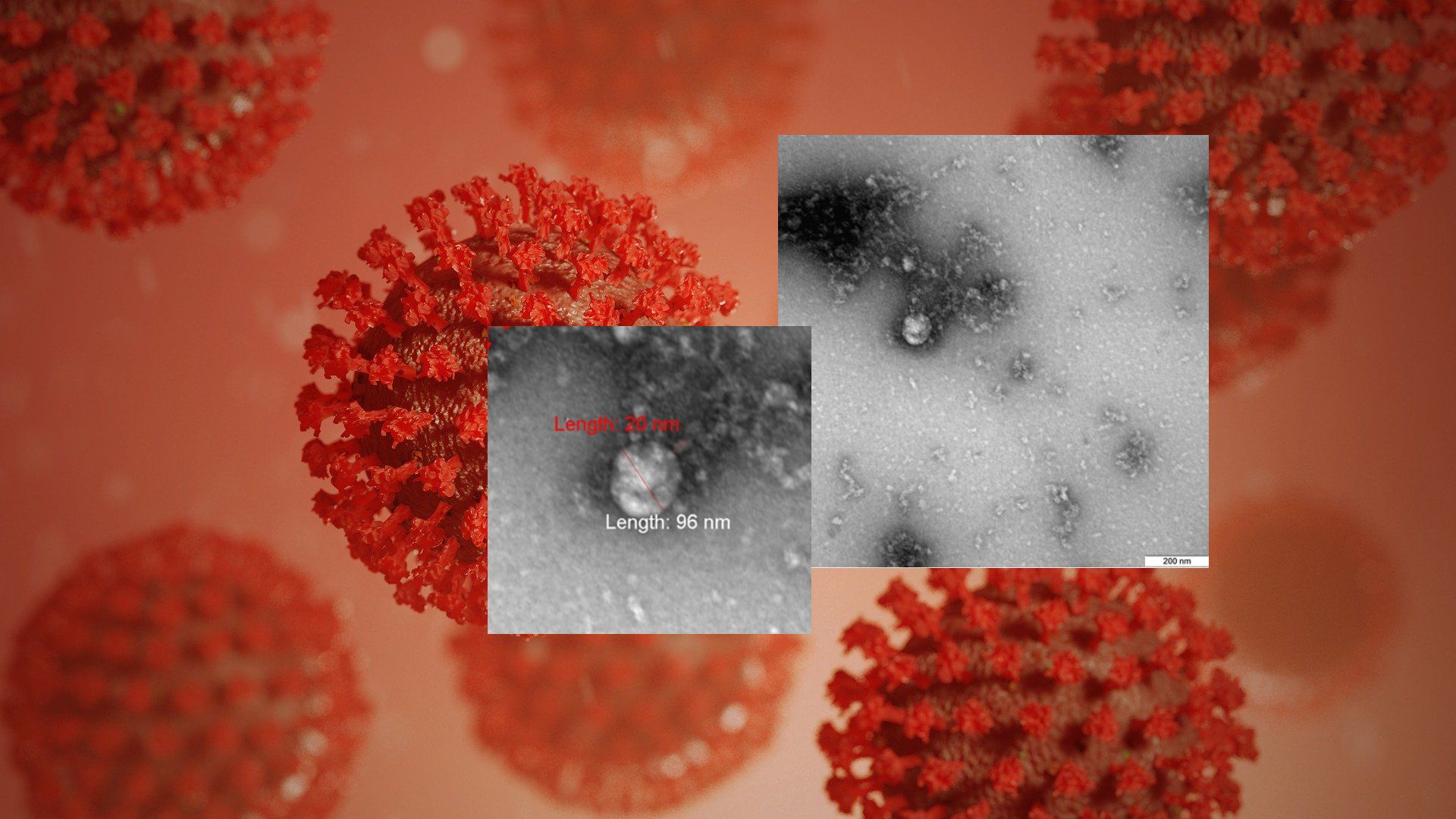 Ковид новый штамм 2023. Вирус Covid 19 под микроскопом. Штаммы коронавируса под микроскопом. Коронавирус 2020 под микроскопом. Гамма штамм коронавируса.