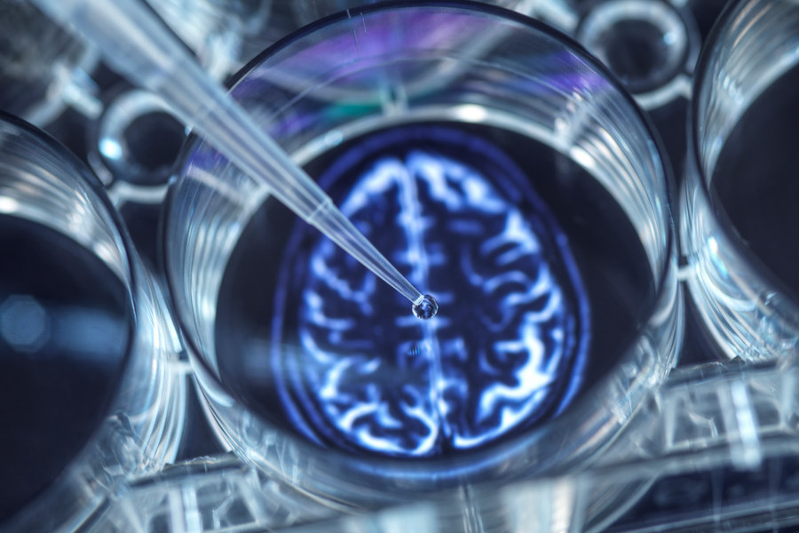 Pipetting potential cure for brain disorders into a multi well plate